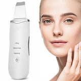 Ultra-Sonic Deep Facial Cleansing Machine Facial Scrubber- USB Charging_3