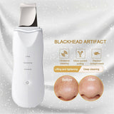 Ultra-Sonic Deep Facial Cleansing Machine Facial Scrubber- USB Charging_8