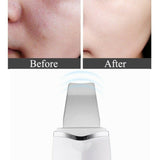 Ultra-Sonic Deep Facial Cleansing Machine Facial Scrubber- USB Charging_9