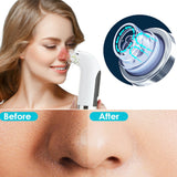 USB Rechargeable Electric Pore Blackhead Vacuum Cleaner_1