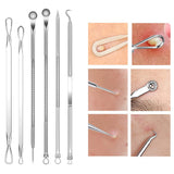 15Pcs  Stainless Steel Blackhead Remover Pimple Popper Tools Kit with Metal Case_4