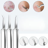 15Pcs  Stainless Steel Blackhead Remover Pimple Popper Tools Kit with Metal Case_5